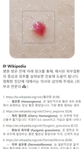 Model Dermatol – Skin Disease screenshot