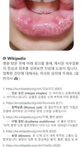 Model Dermatol – Skin Disease screenshot