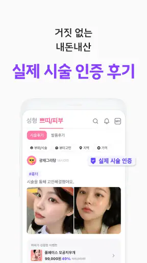 바비톡 - 800만이 선택한 대표 성형/시술 플랫폼 screenshot