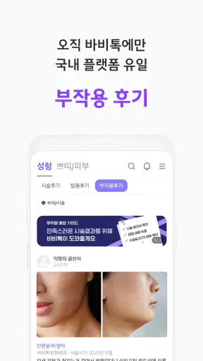 바비톡 - 800만이 선택한 대표 성형/시술 플랫폼 screenshot