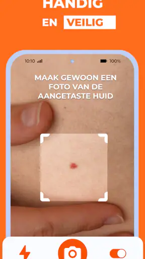 AI Huidmonitor scan - Skinive screenshot
