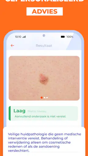 AI Huidmonitor scan - Skinive screenshot