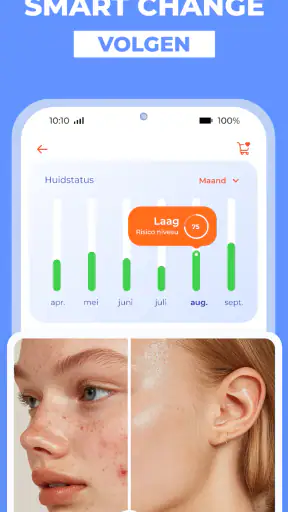 AI Huidmonitor scan - Skinive screenshot