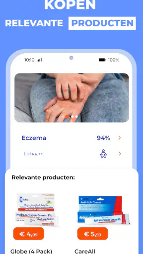 AI Huidmonitor scan - Skinive screenshot