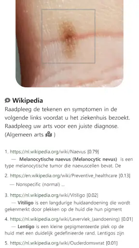 Model Dermatol – Huidziekte screenshot