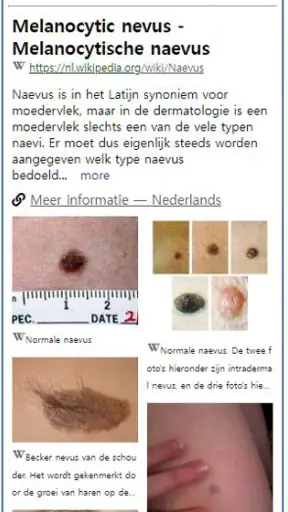 Model Dermatol – Huidziekte screenshot