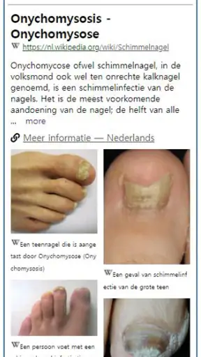 Model Dermatol – Huidziekte screenshot