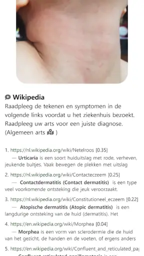 Model Dermatol – Huidziekte screenshot