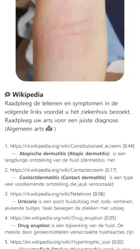 Model Dermatol – Huidziekte screenshot