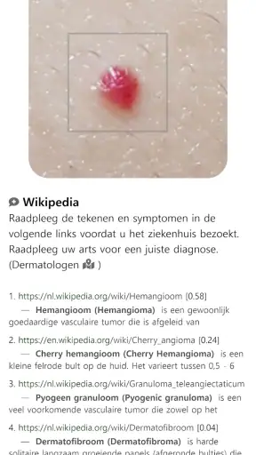 Model Dermatol – Huidziekte screenshot
