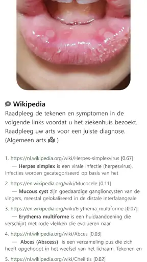 Model Dermatol – Huidziekte screenshot