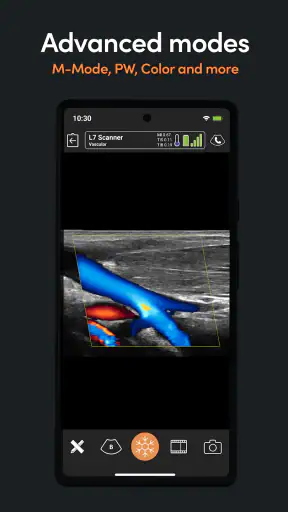 App de Ultrassom Clarius screenshot