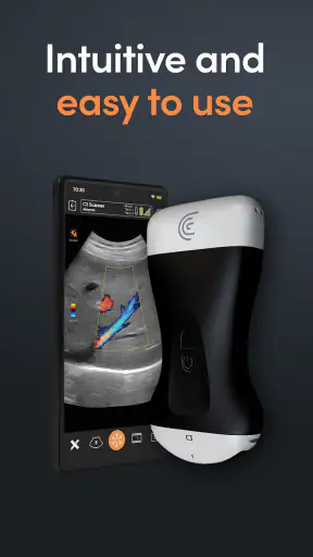 App de Ultrassom Clarius screenshot