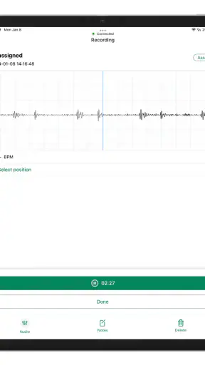 Eko: estetoscópios digitais screenshot
