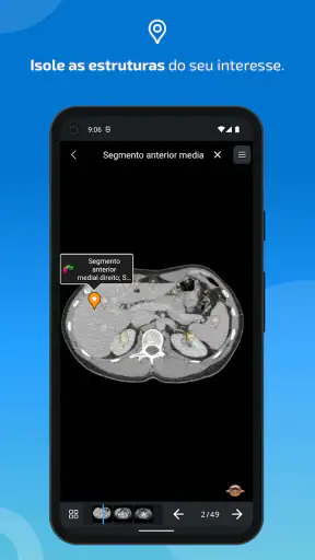 IMAIOS e-Anatomy screenshot