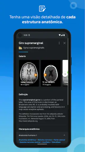 IMAIOS e-Anatomy screenshot