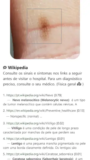 Model Dermatol– Doença de pele screenshot