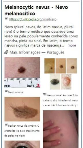 Model Dermatol– Doença de pele screenshot