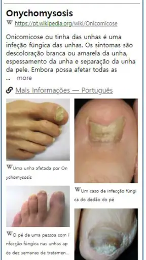 Model Dermatol– Doença de pele screenshot