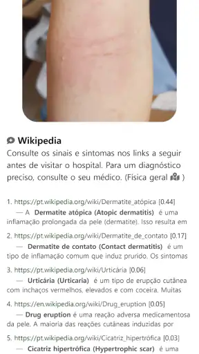 Model Dermatol– Doença de pele screenshot