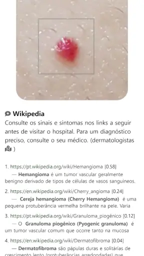 Model Dermatol– Doença de pele screenshot