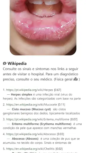 Model Dermatol– Doença de pele screenshot