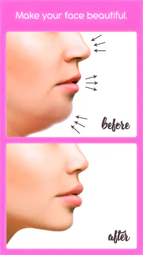 Rinoplastia screenshot