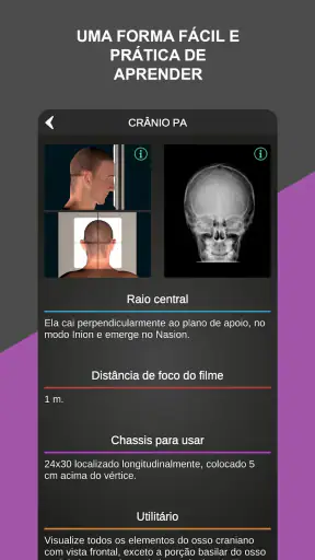RX - Radiologia Posicionamento screenshot