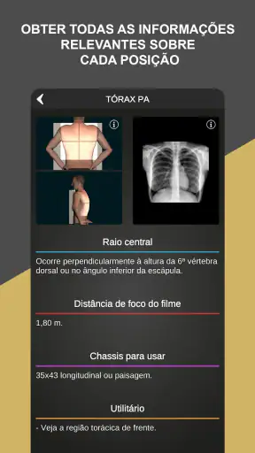 RX - Radiologia Posicionamento screenshot