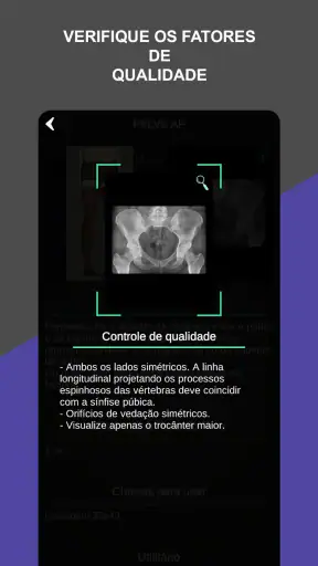 RX - Radiologia Posicionamento screenshot