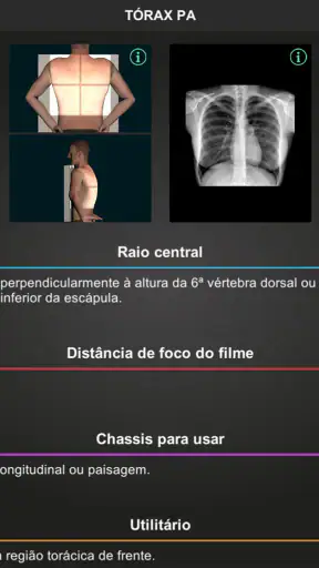 RX - Radiologia Posicionamento screenshot