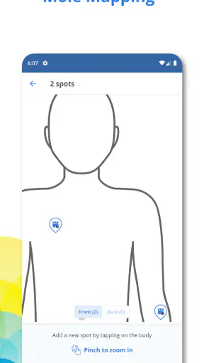 SkinVision screenshot