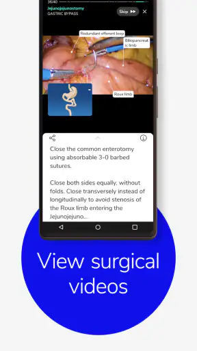 Touch Surgery: Surgical Videos screenshot